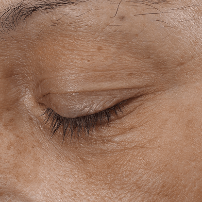 Bio - Renew EGF Eye Cream - Glo Skin Beauty UK&I