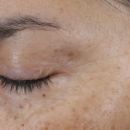 Bio - Renew EGF Eye Cream - Glo Skin Beauty UK&I