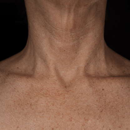 Bio - Renew EGF Neck Cream - Glo Skin Beauty UK&I