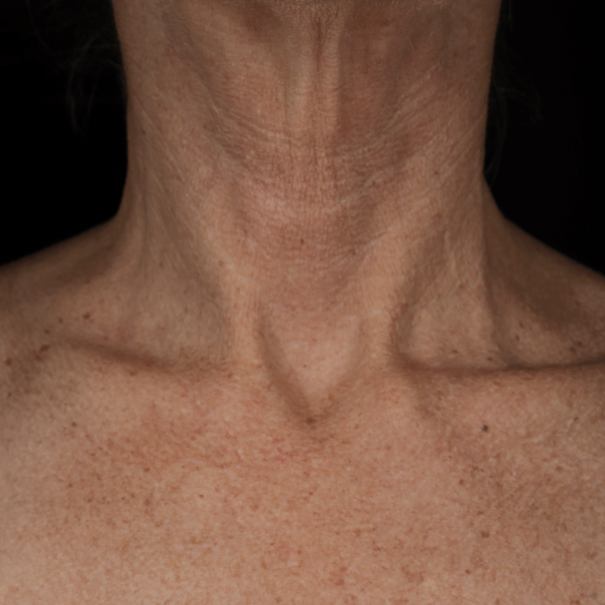 Bio - Renew EGF Neck Cream - Glo Skin Beauty UK&I