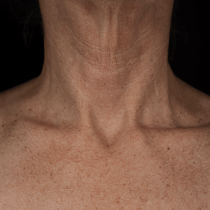 Bio - Renew EGF Neck Cream - Glo Skin Beauty UK&I